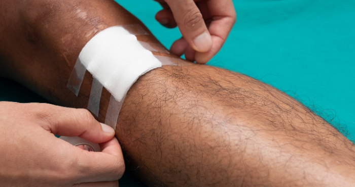 man applying plaster to pressure ulcer on leg