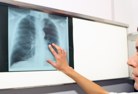 HCP looking at chest x-rays