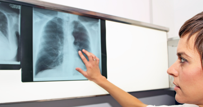 HCP looking at chest x-rays