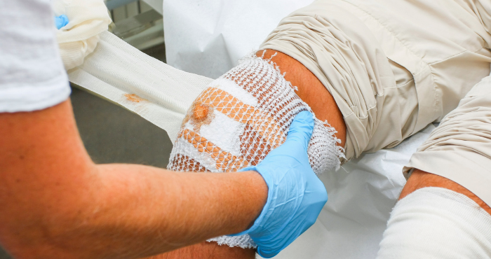 An overview of nutrition and wound healing